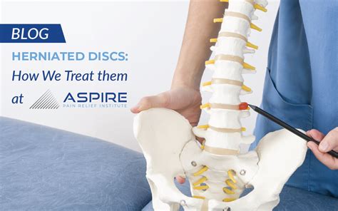 Herniated Discs How We Treat Them At Aspire Aspire Pain Relief Institute