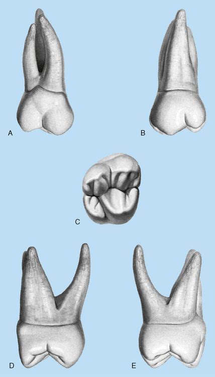 Maxillary Third Molar Anatomy Dental Art Dental Anatomy Dental