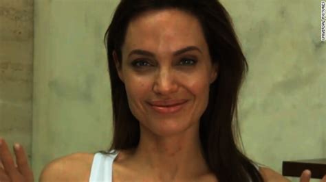Angelina Jolies Chickenpox Explained Cnn