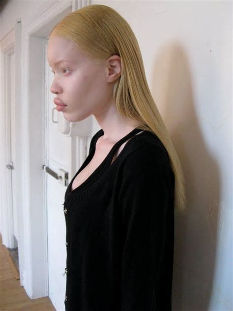 Tumblr Diandra Forrest Model Portrait Albino Editorial