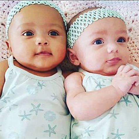 Biracial Twins — See Pics Kalani And Jarani Sisters With Different Skin