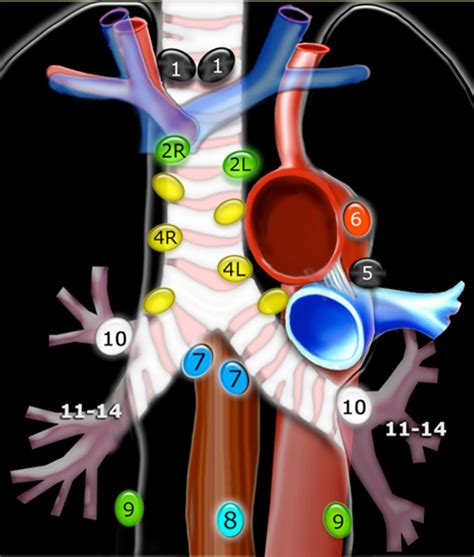 Lymph Node Stations In The Mediastinum Lymph Node Stations 3a And B