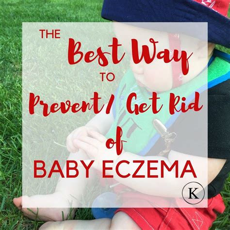 Kindred Kaylee The Best Way To Prevent Get Rid Of Baby Eczema Baby