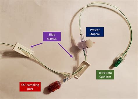 Setup And Use Of Codman Drainage Unit For Lumbar Csficp Monitoring Lhsc