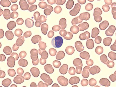 White Blood Cells What Are White Blood Cells