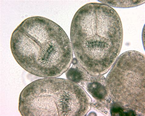 Echinococcus Cysts Of A Small Taeniid Type Tapeworm Echinococcus Granulosus Histology Slides