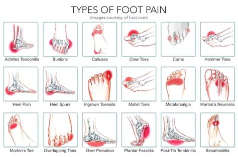 Get Rid Of Foot Pain Within Minutes With These Effective Stretches