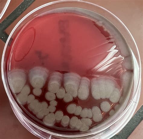 Bacillus Subtilis Is A Gram Positive Rod Shaped Bacterium That Forms