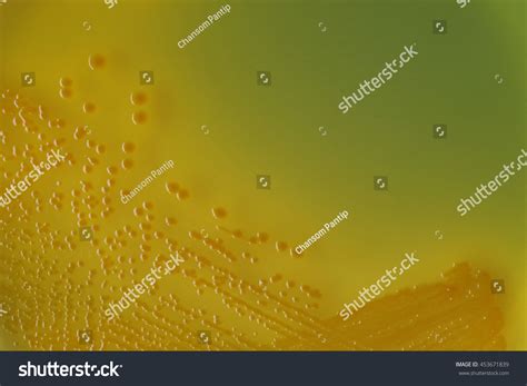 Vibrio Cholerae Bacterial Colonies On Tcbs Stock Photo 453671839
