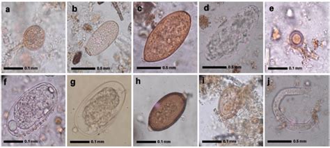 Photomicrographs Of Gastrointestinal Parasites In Faecal Samples Of Six