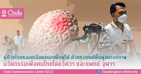 ผู้ป่วยโรคหลอดเลือดสมองฟื้นฟูได้ ด้วยหุ่นยนต์ฟื้นฟูสมรรถภาพ นวัตกรรม
