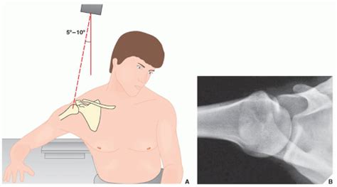 Upper Limb I Shoulder Girdle Radiology Key