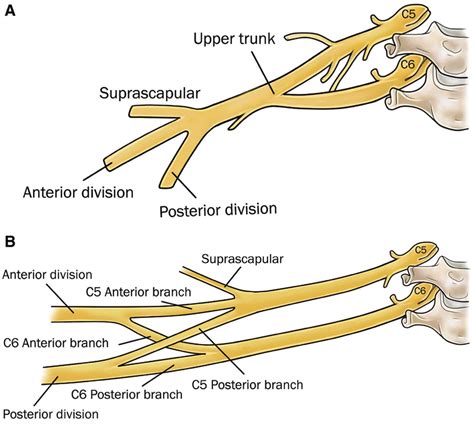 A Diagram Illustrating The Normal Brachial Plexus Anatomy A Compared