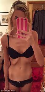 Anorexic Essex Woman Who Was A Size Zero Is Saved By Instagram Daily Mail Online