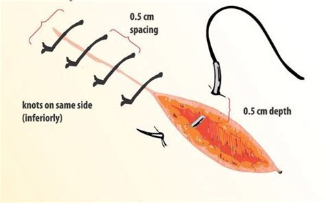 Suturing Techniques Gmd Group
