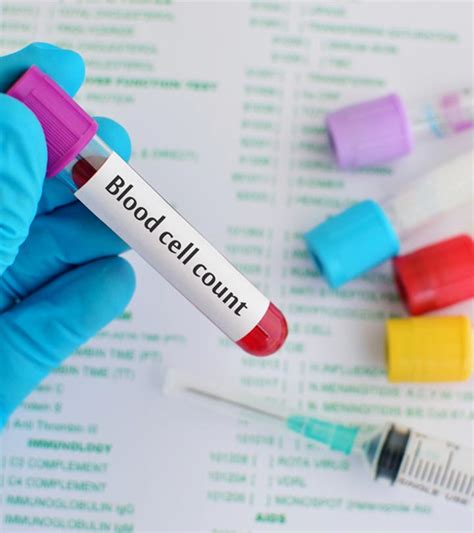Include these foods in your diet & be ready to see a surprising result. How To Increase White Blood Cell Count: 15 Natural Remedies