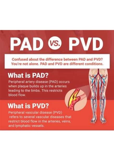 Pad Vs Pvd What Are The Differences Usa Vascular Centers Pdf