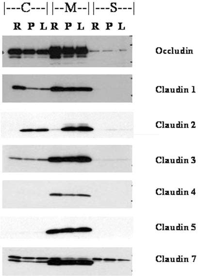 Western Blot Analysis Of Integral Tight Junction Proteins In Three