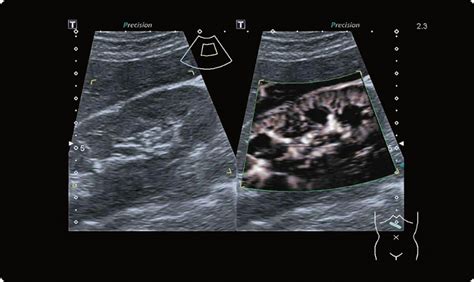 Diagnostic Ultrasound Canon Medical Systems Sweden