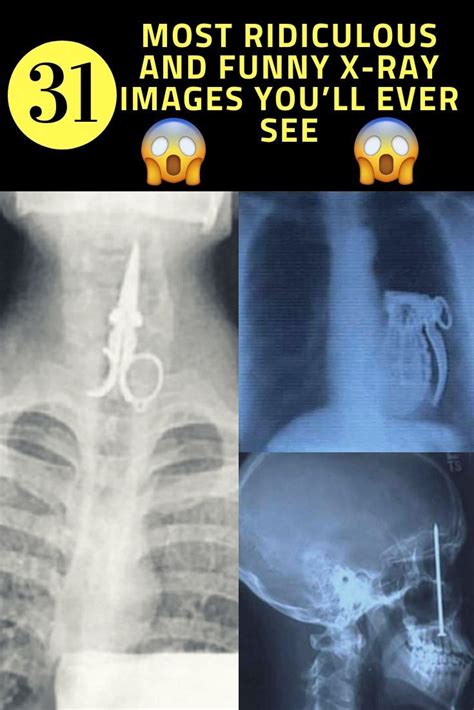 The Most Ridiculous And Funny X Ray Images Youll Ever See X Ray