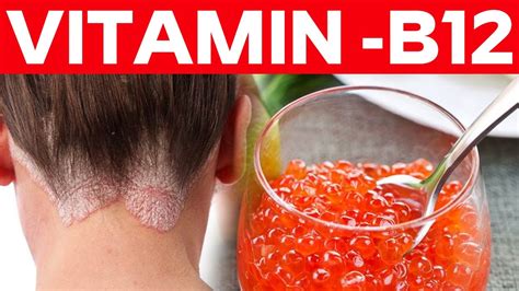 You Need To Know About Vitamin B12 Benefits For Health Skin Hair