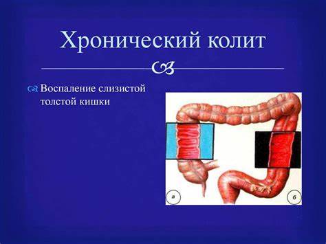 Заболевания кишечника с запорами диета