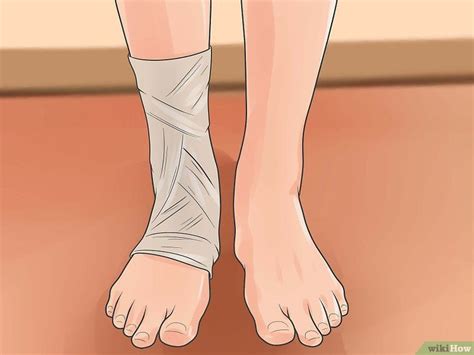 4 Ways To Treat A Sprained Ankle Treating A Sprained Ankle Sprained