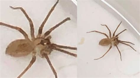 Doctors Find Venomous Brown Recluse Spider Inside Kansas City Missouri