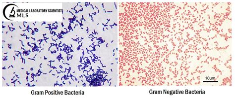Gram Stain Purpose Procedure Results And More Lab Tests Guide
