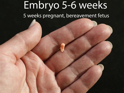 Embryo 5 6 Weeks Baby Loss Memorial Baby Pregnancy Loss Infertility