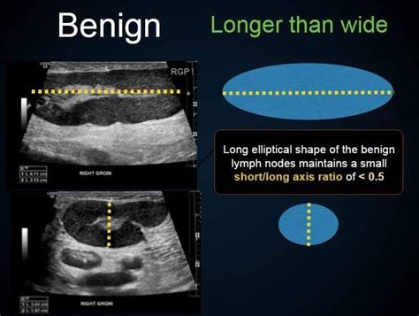 Pin By Mourad Salama On Sonography Medical Ultrasound Diagnostic