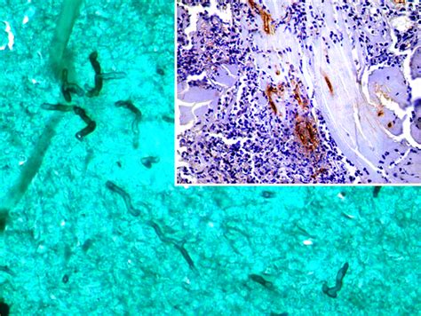 Scielo Brasil Equine Pythiosis In The Eastern Wetlands Of Uruguay