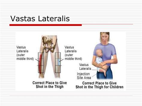 ppt intramuscular injection powerpoint presentation free download id 1452695