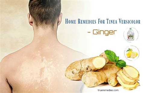 Home Cure For Tinea Versicolor Homemade Ftempo