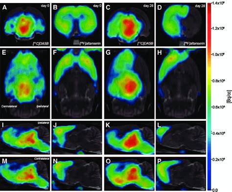 Normalized Positron Emission Tomography Pet Images Of 11 C Dasb And