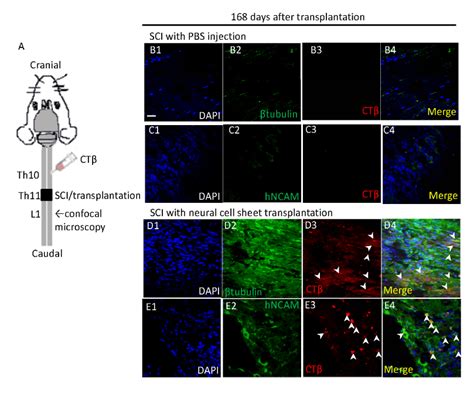 Human Ips Cell Derived Neural Cell Sheets Exhibit Mature Neural And