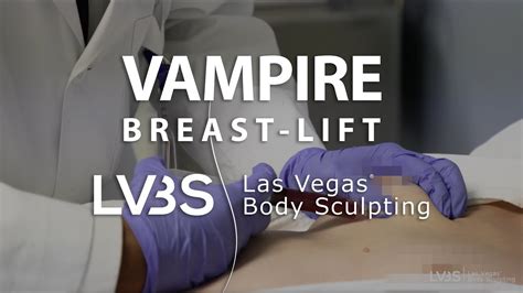 Vampire Breast Lift By Las Vegas Body Sculpting YouTube
