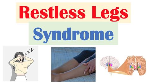 Restless Legs Syndrome Rls Causes Signs And Symptoms Diagnosis