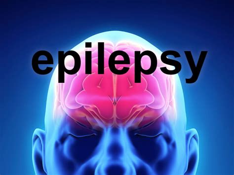 Researchers Identify Treatment For Drug Resistant Epilepsy