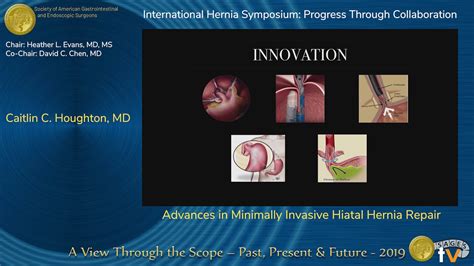 Advances In Minimally Invasive Hiatal Hernia Repair Youtube