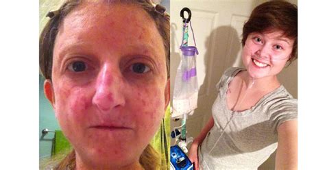 Facebook Banned Her Photo So She Started This Selfie Challenge The Mighty