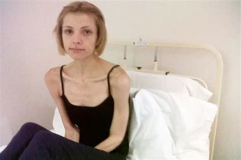 Solihull Anorexic Teen Left To Die By Nhs Birmingham Mail