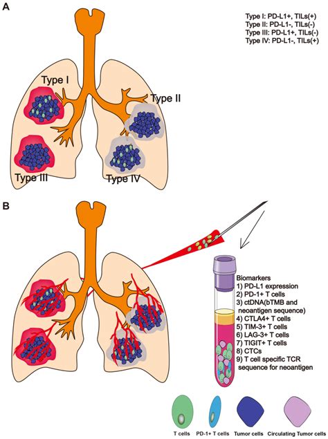 This type of cancer is rare and is. Liquid biopsy for lung cancer immunotherapy (Review)