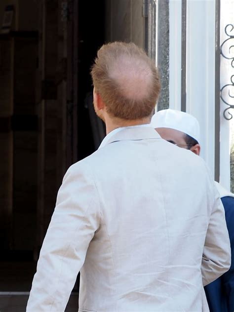 Prince Harrys Huge Bald Spot Pictured On South Africa Mosque Visit