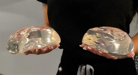 Huge Overfilled Breast Implants Great Porn Site Without Registration