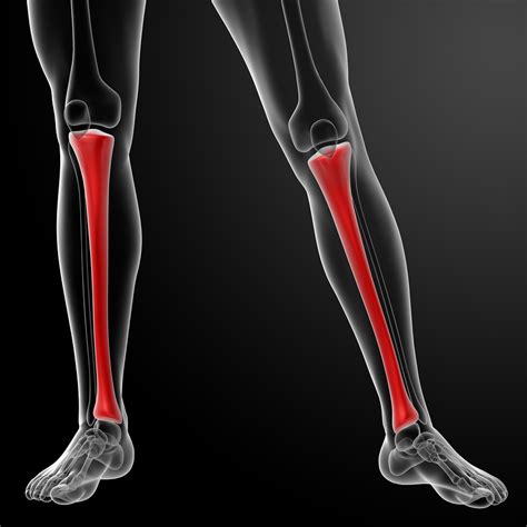 Shin Splints: What to do if your shin splints won't go away.