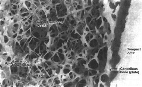 Photograph Of A Section Of A Tibia Showing Trabecular Cancellous And
