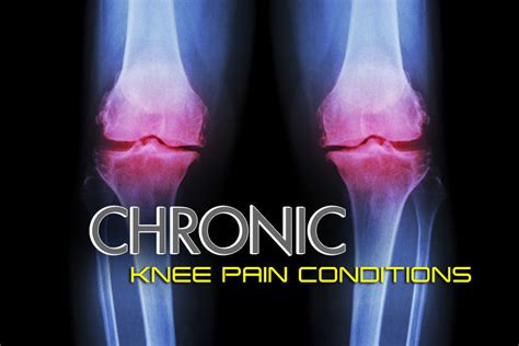 Recognizing Chronic Knee Pain Conditions From Osteoarthritis To Runne