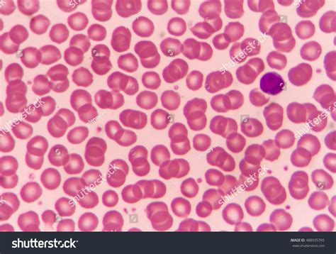 Normal Red Blood Cells Under Microscope Stock Photo