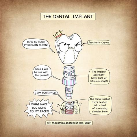 The Dental Implant The Comical Anatomist Dental Implants Medical